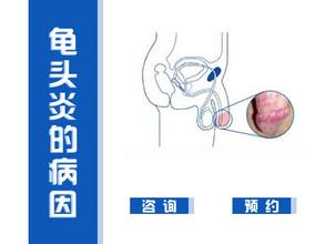 海南内丘包皮龟头炎的治疗费用要多少钱！